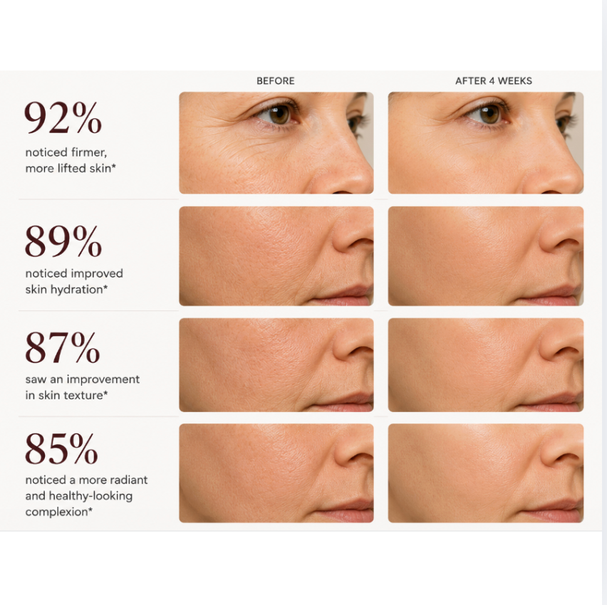 A before-and-after comparison chart showing close-up side views of a woman's face and neck over 4 weeks, with text claiming 92%, 89%, 87%, and 85% improvements in skin tone, firmness, hydration, and texture.